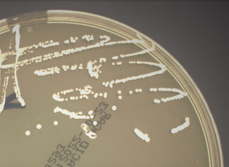 runde, elfenbeinfarbene Kolonien auf der Oberfläche eines festen, durchsichtig-gelben Mediums